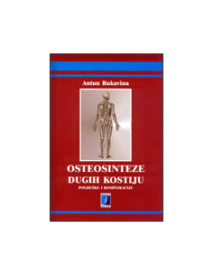 OSTEOSINTEZE DUGIH KOSTIJU - pogreške i komplikacije